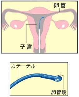 FTの手順