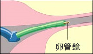 FTの手順